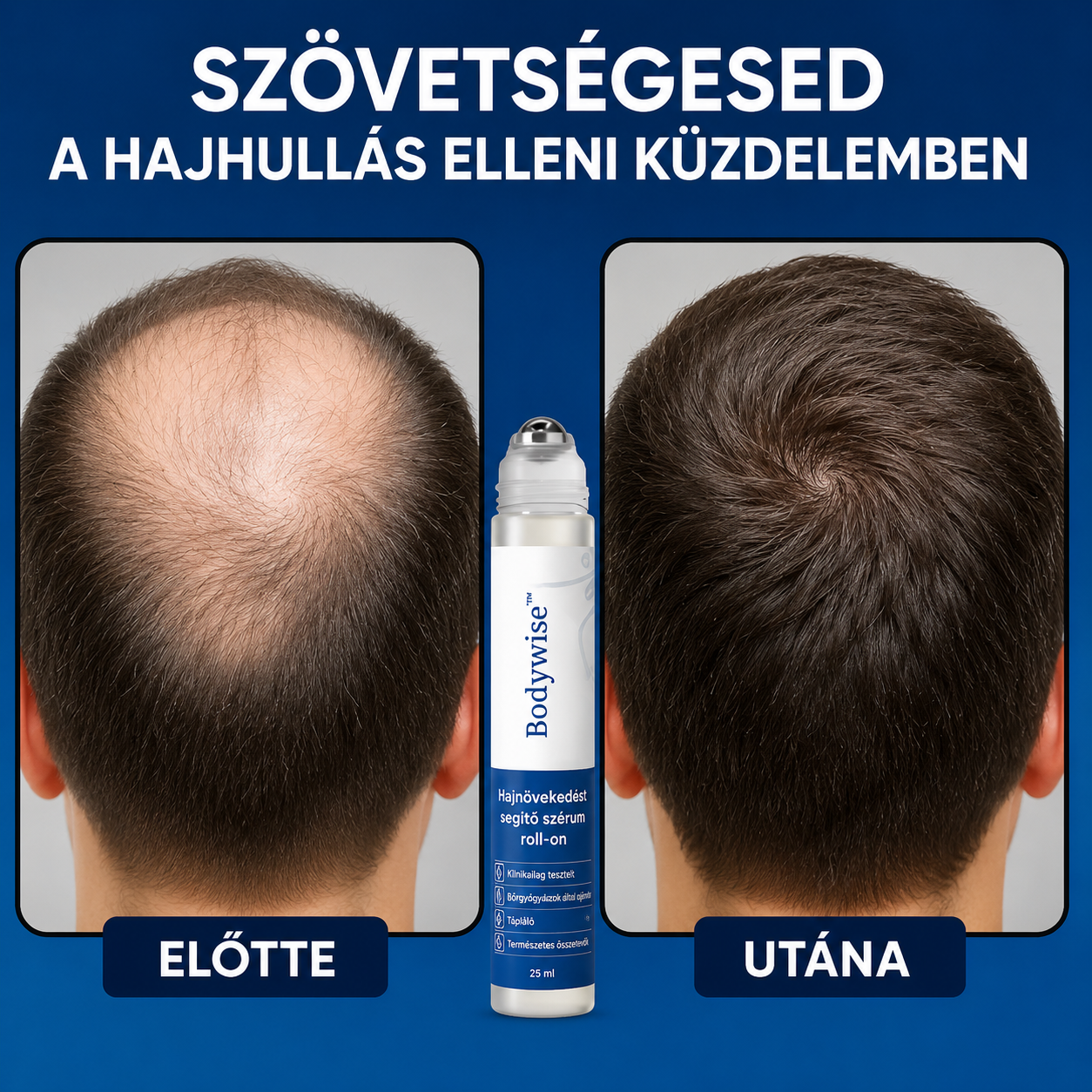 Fejlett hajnövesztő roll-on szérum